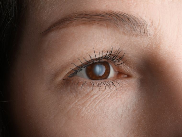 August is Cataract Awareness Month