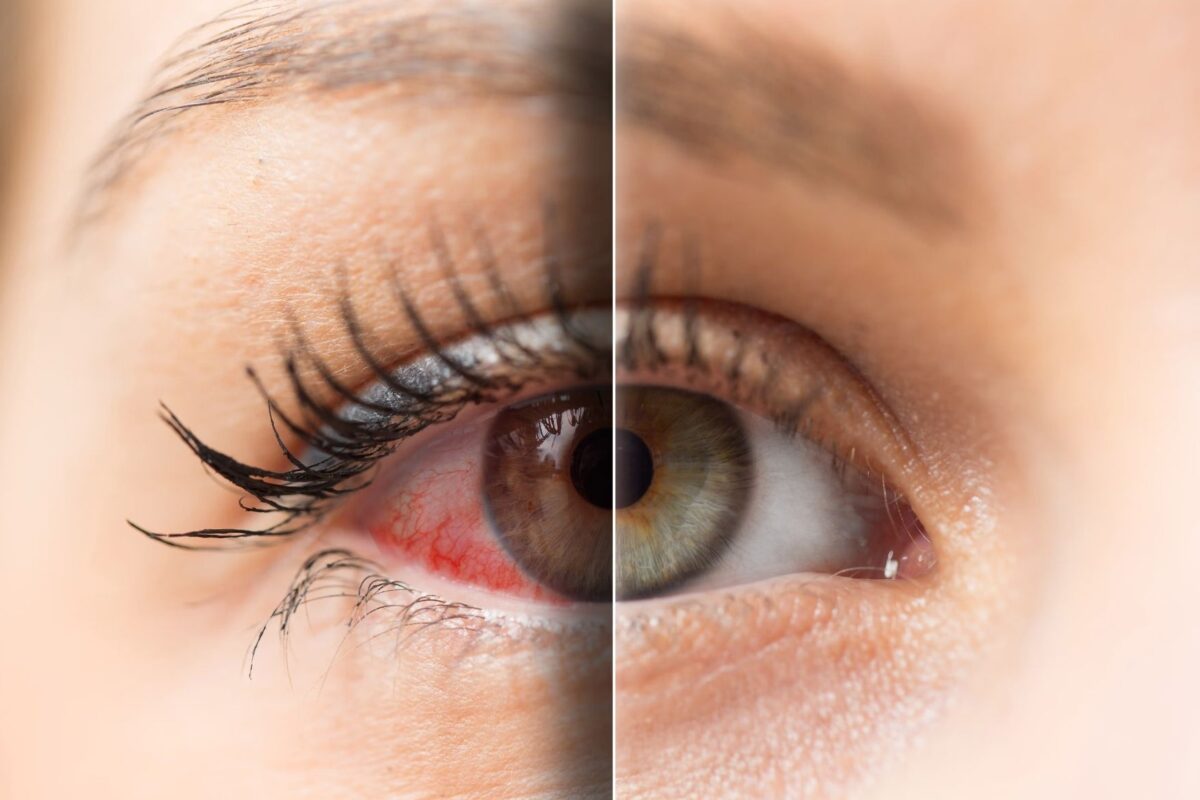 Regenerative Medicine and Ocular Surface Diseases